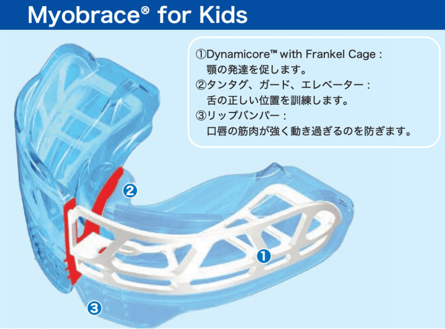マイオブレースのイメージ